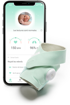 Owlet - Babyphone Owlet Smart Sock 3